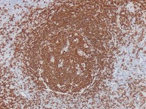 3050B | Control Slides:Immunopathology; CD20, B-Cell